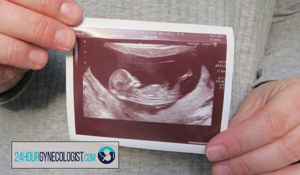 معاینه رحم، تخمدان ها، دهانه رحم و واژن به منظور تشخیص ناهنجاری های دوران بارداری