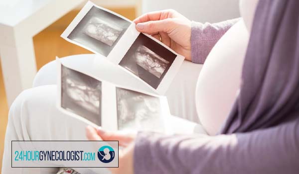 سونوگرافی سه ماهه دوم و سوم حاملگی