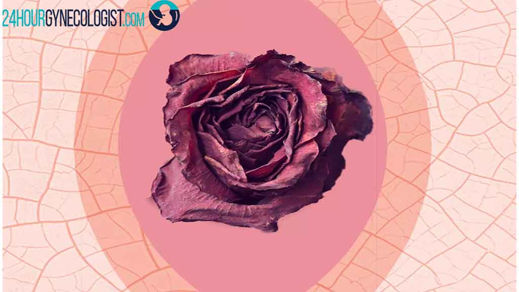 درمان خشکی واژن در شیراز + بهترین دکتر درمان آتروفی واژن در شیراز